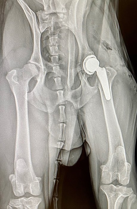 postoperative Röntgenaufnahme