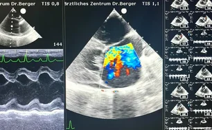 Aufnaheme eine Kardiogramms