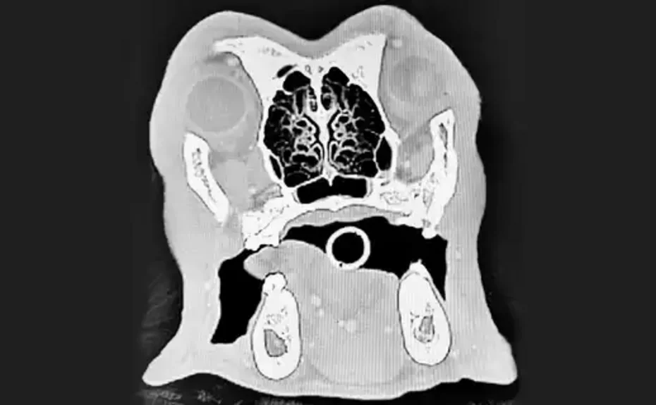 Aufnahme eines CT-Schädel Querschnitts - Fachbereich oromaxillofaziale Chirurgie des FTZ Berger